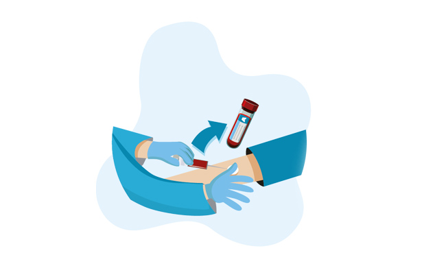 Echantillons-du-sang-ou-serums-humain