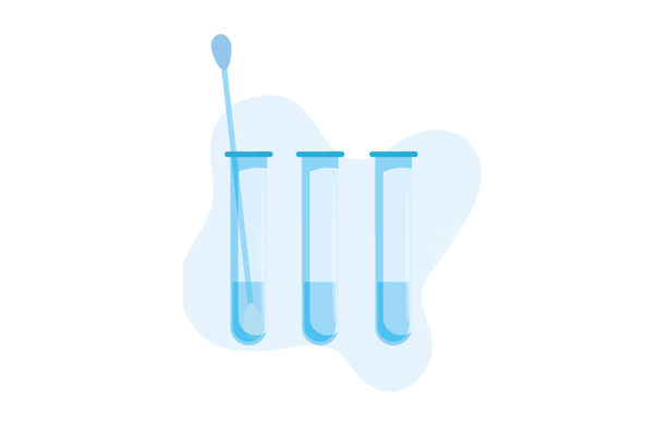 Extraction-des-ARN-nasopharynge