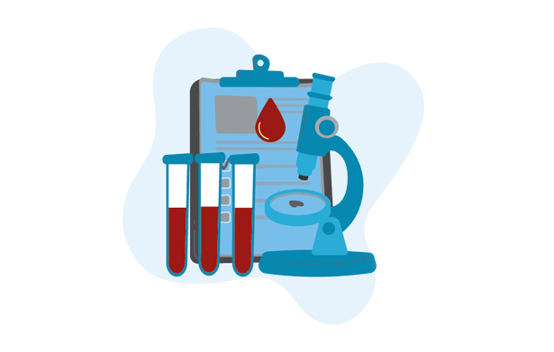 Extraction-des-ARN-serums